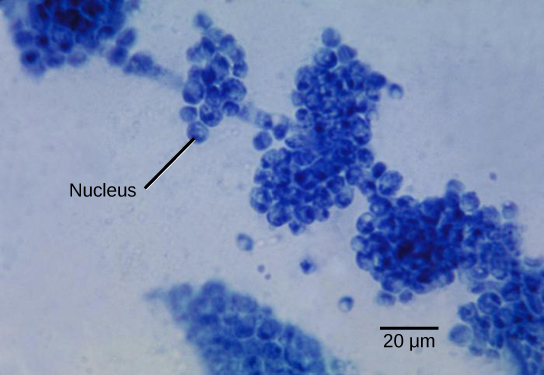 Micrograph shows clumps of small blue spheres. Each sphere is about 5 microns across.