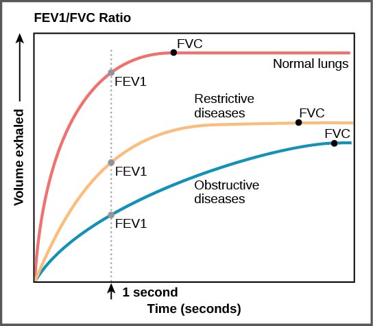 The graph plots volume exhaled versus time. In normal lungs, almost all of the air can be forcibly exhaled within one second after taking a deep breath, resulting in a curve that rises steeply at first then plateaus shortly after one second. The volume at which the plateau is reached is the FVC. In lungs of persons with restrictive lung disease, the FVC is considerably lower but the person can exhale reasonable fast, resulting in a curve that is similar in shape, but with a lower plateau, or FVC, than for normal lungs. In lungs of persons with obstructive lung disease, the FVC is low and exhalation is much slower, resulting in a flatter curve with a lower plateau.